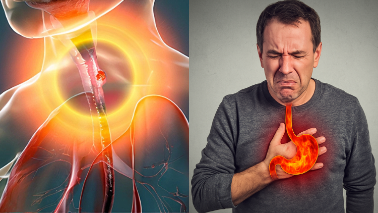 Senza titolo (750 x 422 px) (1)