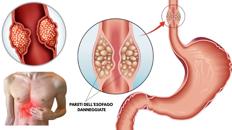Senza titolo (750 x 422 px) (4)